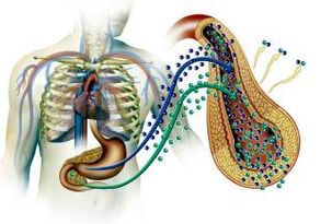 Damage to pancreatic glands in diabetes